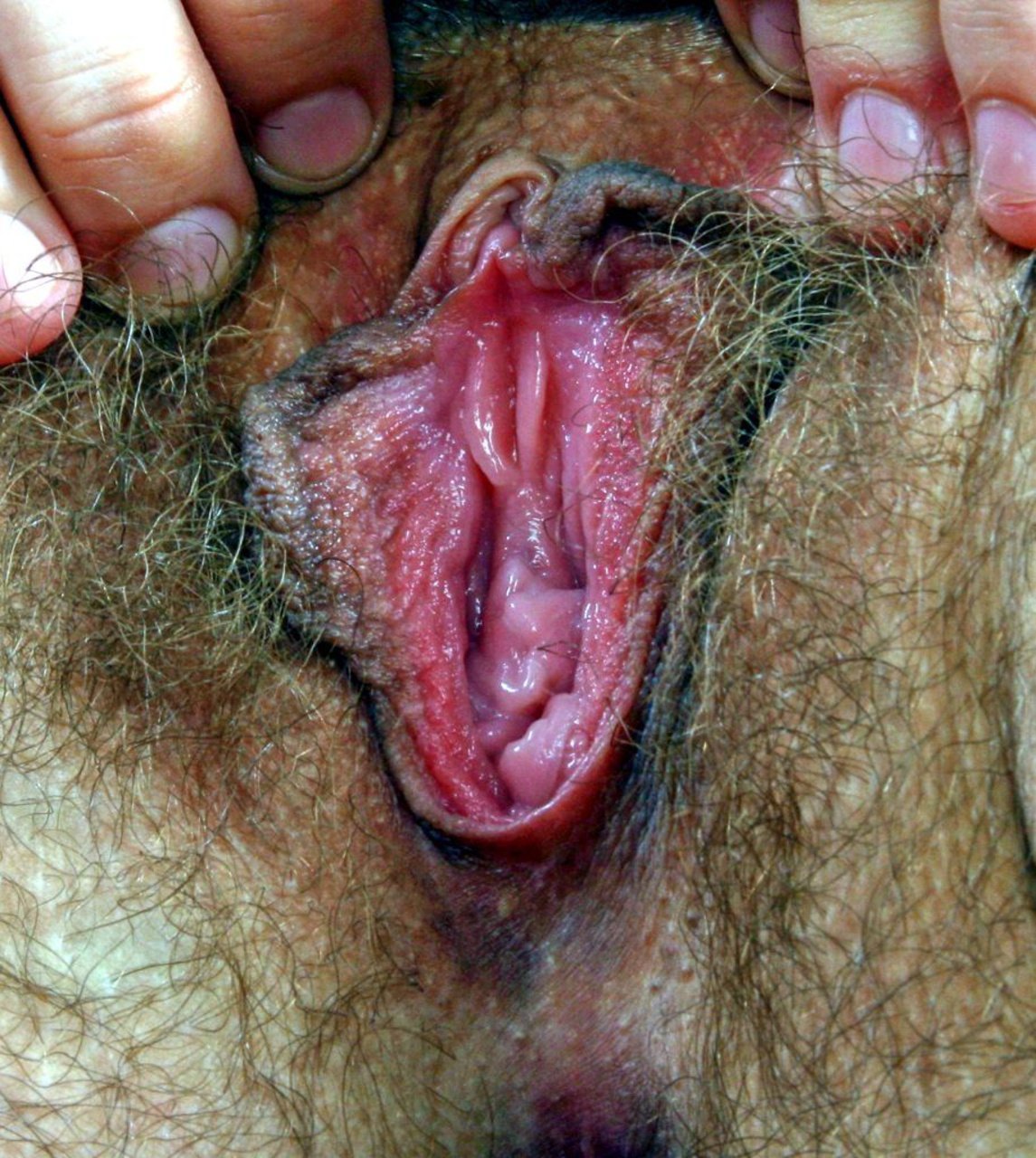 Самые страшные вагины порно (61 фото)