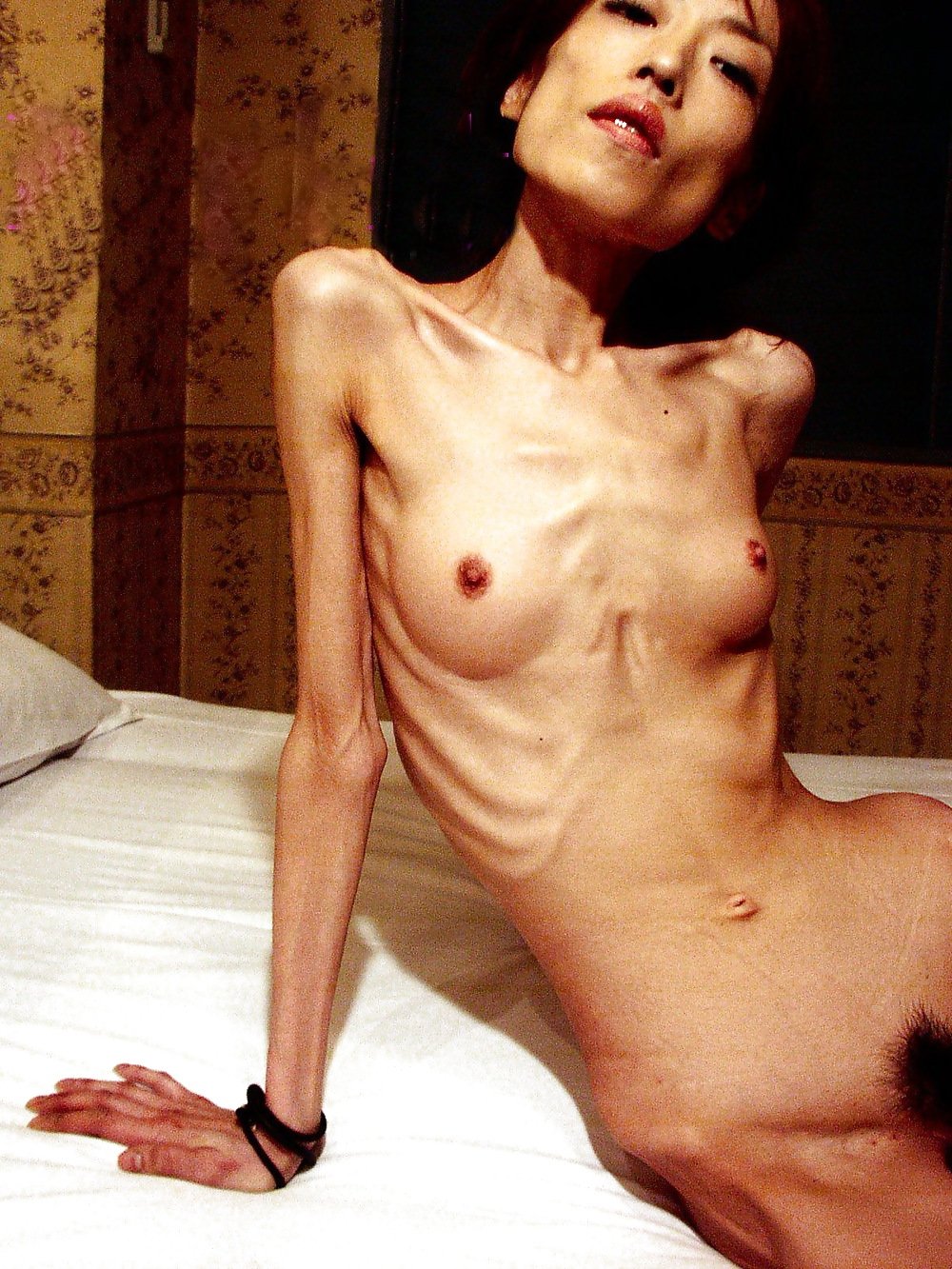 Анорексия фото голых девушек