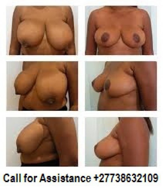 Голые сиськи разного размера