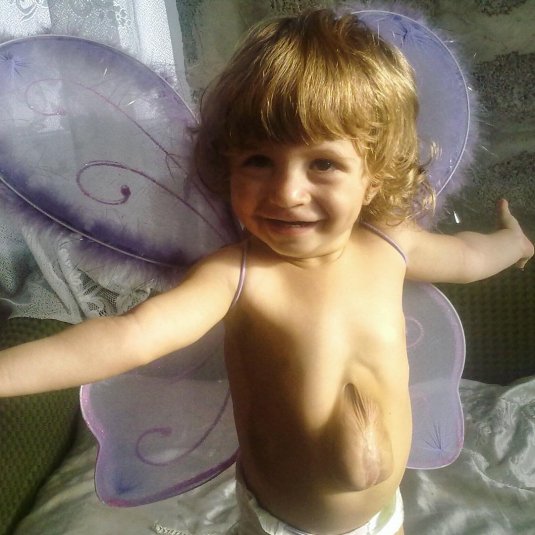 Девочка с сердцем наружу