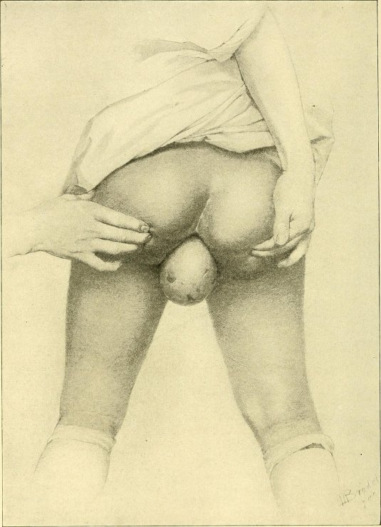 Рисунки женских гениталий