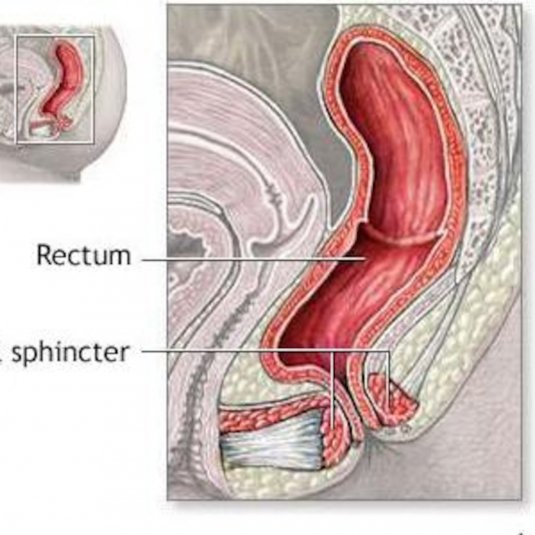 Пролапс слизистой оболочки прямой кишки