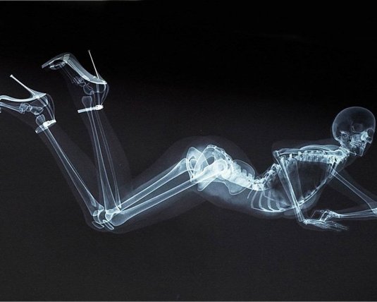 Рентген девушки