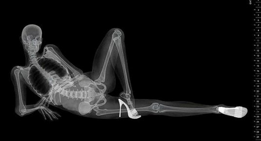 Рентген девушки