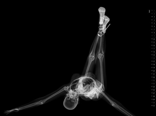 Рентген девушки