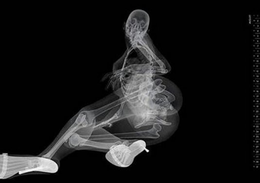 Рентген девушки