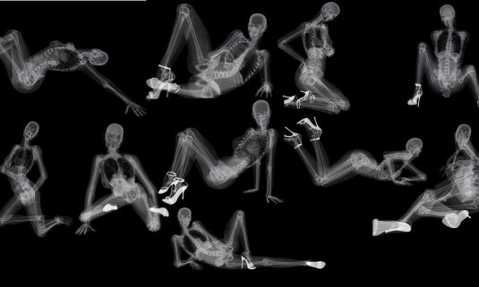 Рентгеновский снимок человека