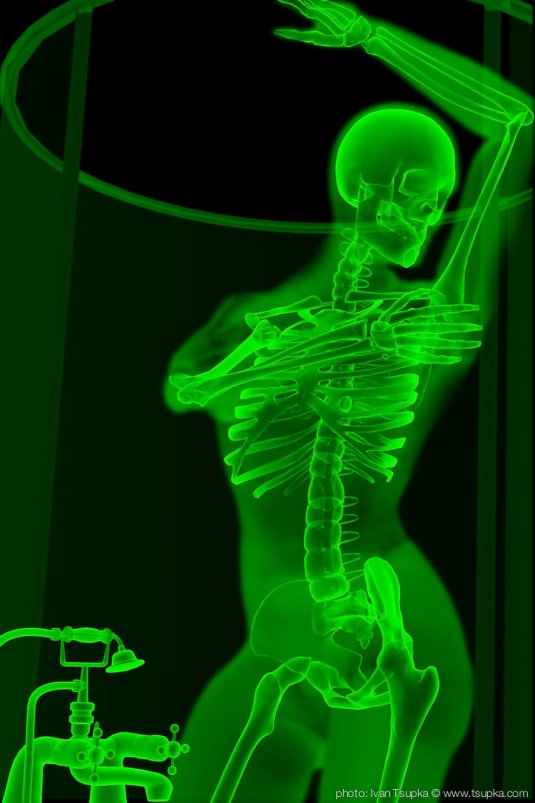 Рентген девушки