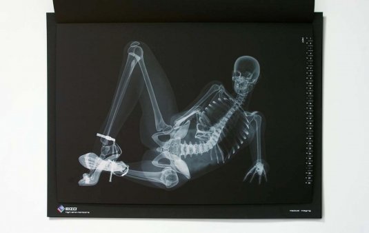 Рентген девушки