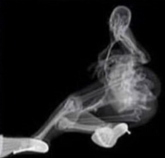 Рентген девушки