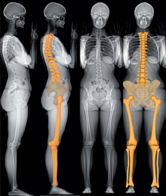 Женский скелет