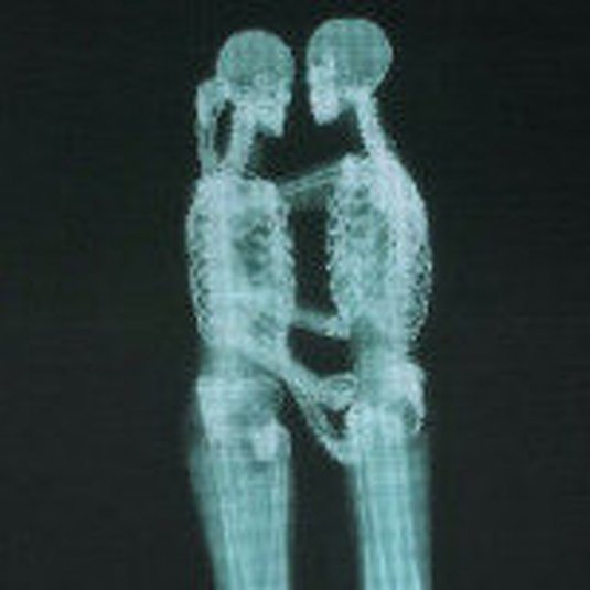 Женщина под рентгеном (45 фото)