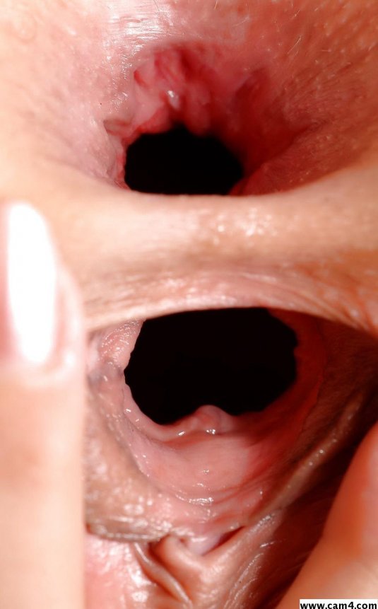 Анальное отверстие вид изнутри