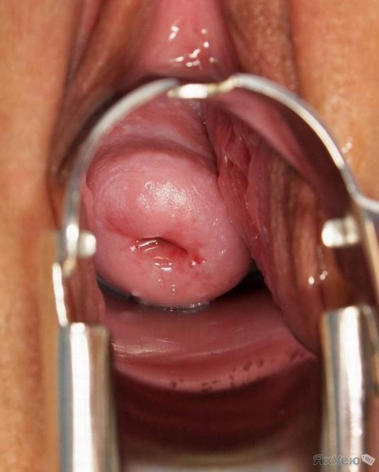 Внутренний вид влагалища