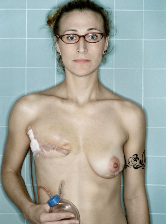 Женщины с некрасивой грудью