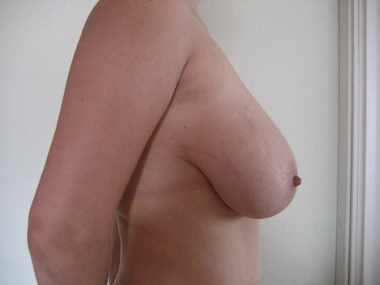 Отвисшие сиськи пожилых селфи