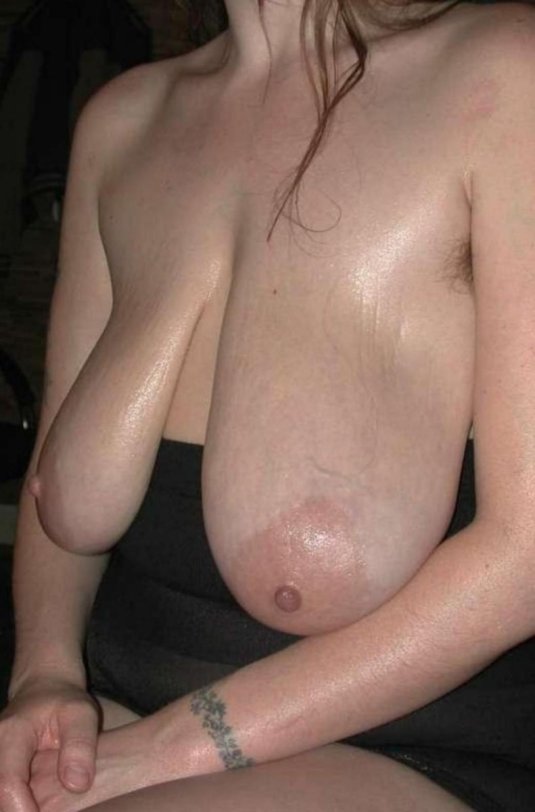 Здоровая грудь