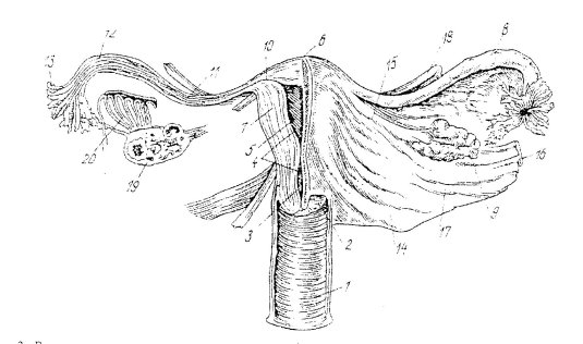 Do shemales have female Reproductive Organs