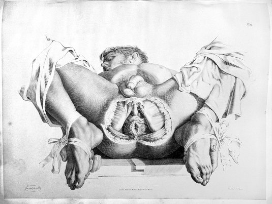 Вагина здоровой женщины