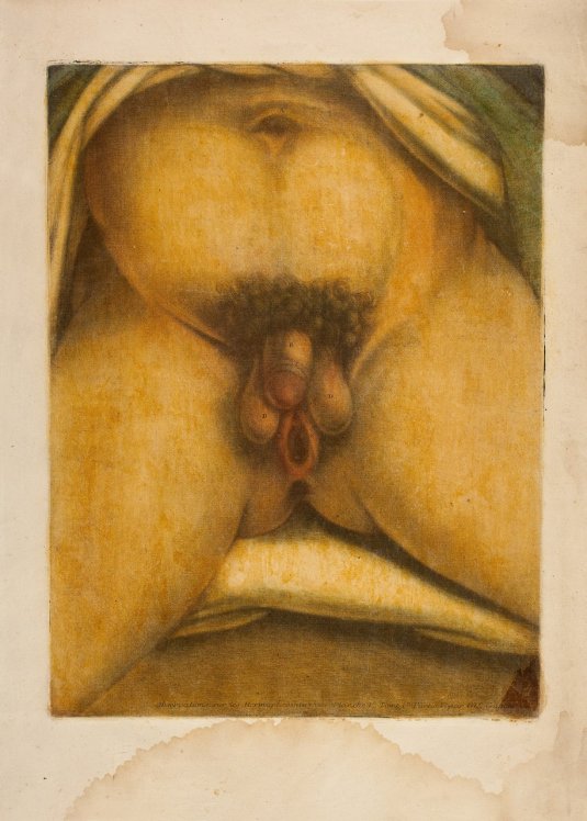 Интерсекс гермафродит