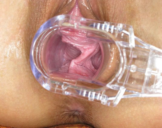 Влагалище и матка изнутри