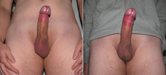 Член голый с закрытой головкой