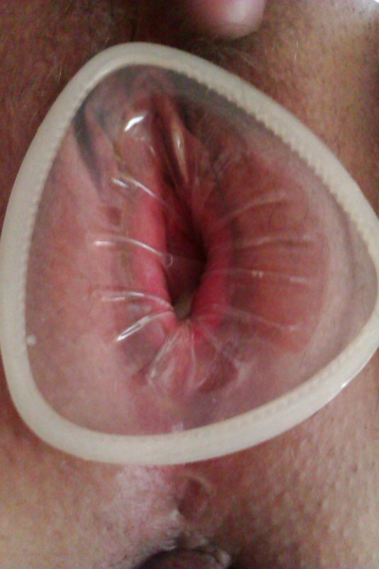 Женские анальные презервативы