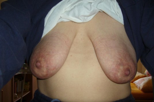 Порно некрасивая грудь (70 фото)