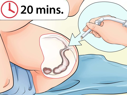 Попина дырочка