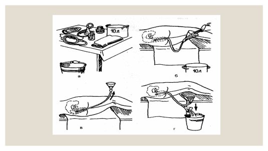 Девайсы эротического плана показать