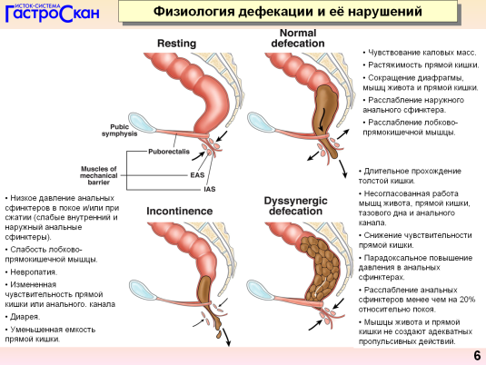 Готовимся к сексу(в деталях)