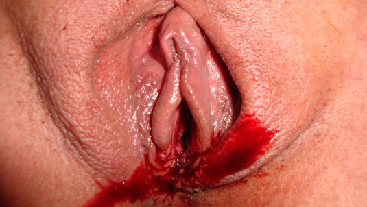 Влагалище менструация