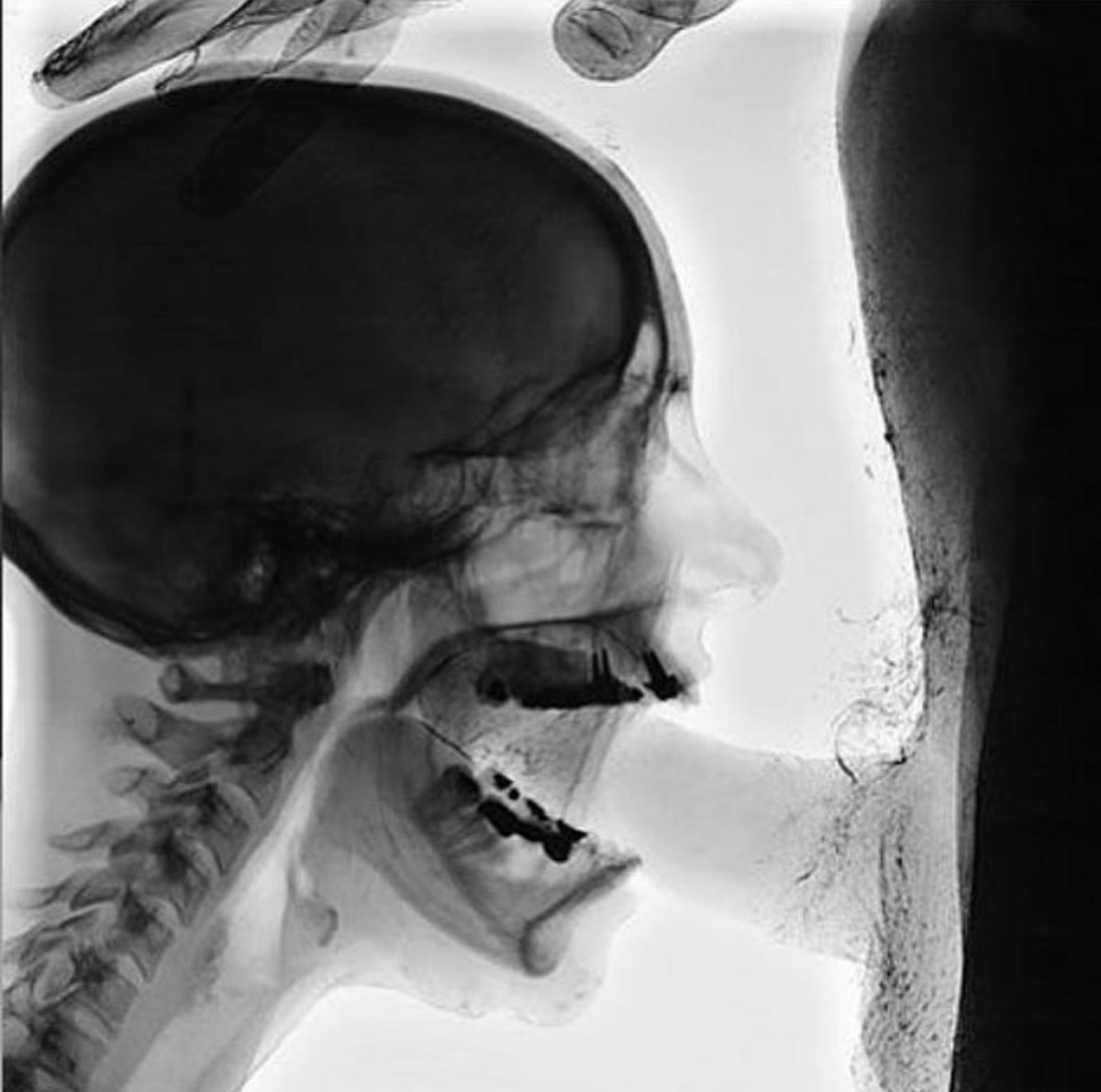 рентген с членом во рту (120) фото