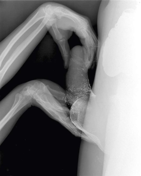 Хентай рентген игрушки