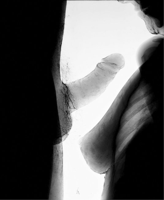 Половой акт под рентгеном