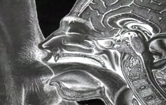 Хентай оплодотворение XRAY futa