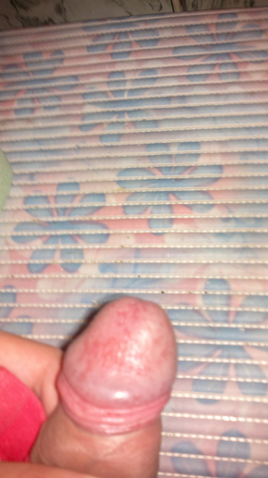 На головке красные пятна