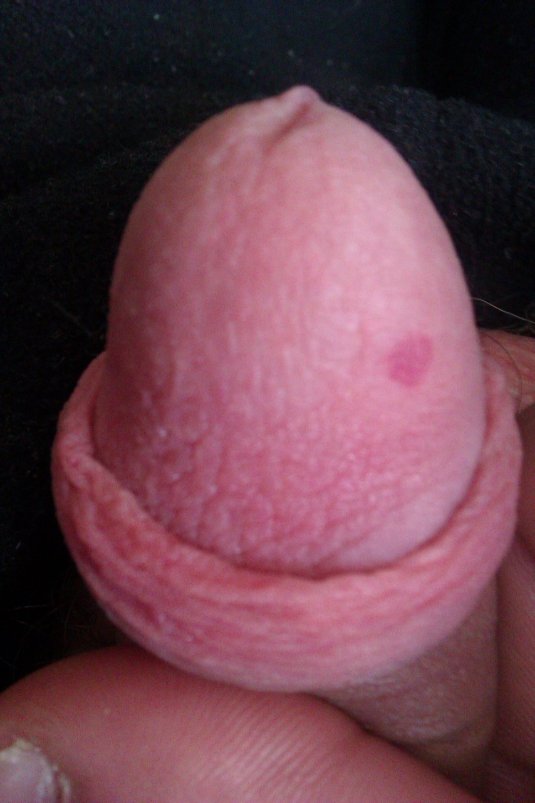 Красные пятнышки на головке