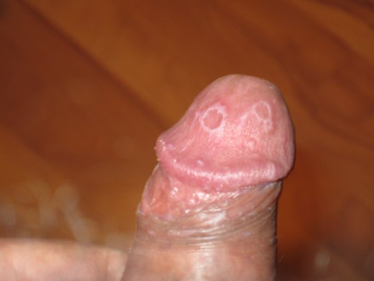 Здоровая головка мужского члена