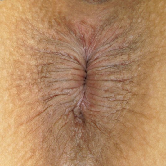 Анальное отверстие с волосами