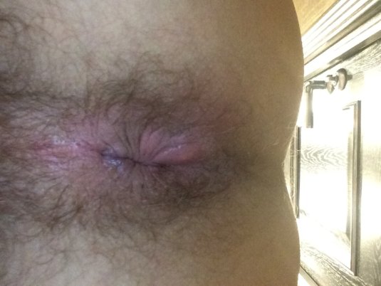 Мужской анус крупным планом