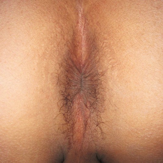 Рыжий волосатый женский анус