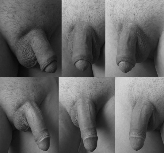 Формы мужских гениталий