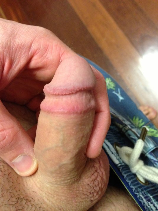 Член с обрезанной крайней плотью