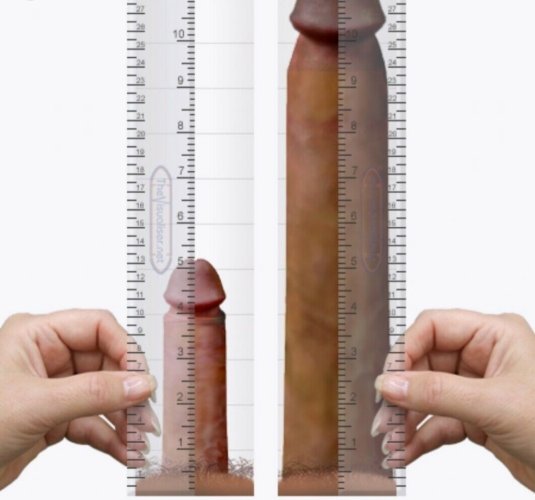 Нормальный размер пениса