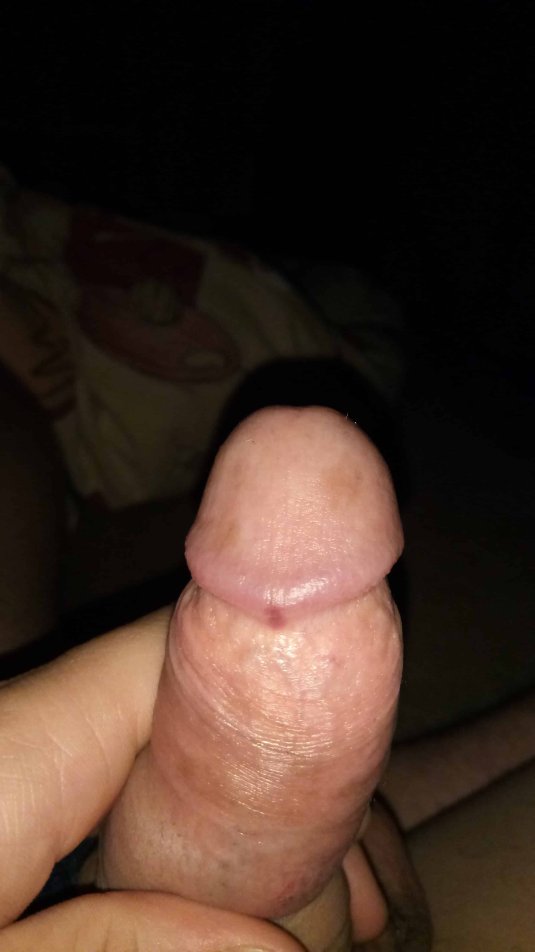 Белые пятнышки на головке пениса