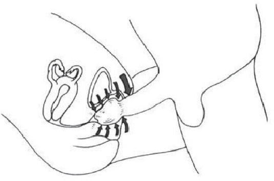 Схема проникновения пениса во влагалище