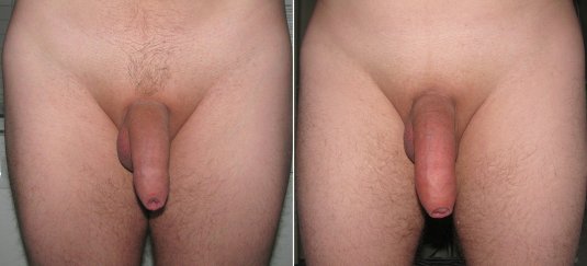 Висячие небольшие члены