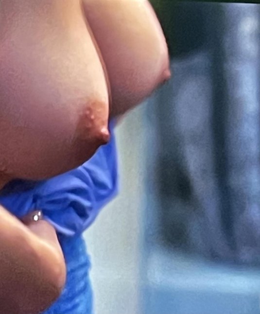 Здоровая грудь