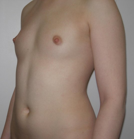 Маленькие груди